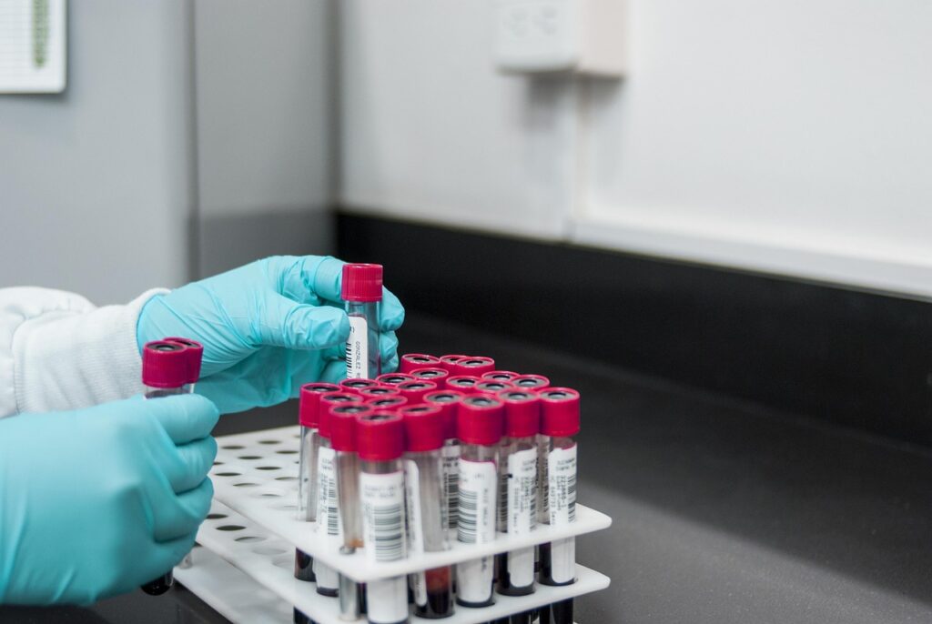 顔脂肪吸引手術の所要時間の目安はどれくらいですか？