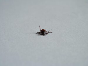 顔の脂肪吸引後のむくみをリンパで流す方法は？