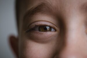 顔の脂肪吸引で小さい子どもを世話する際の心配は？