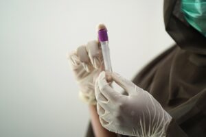 顔脂肪吸引後の肉体労働再開目安はどのくらい？
